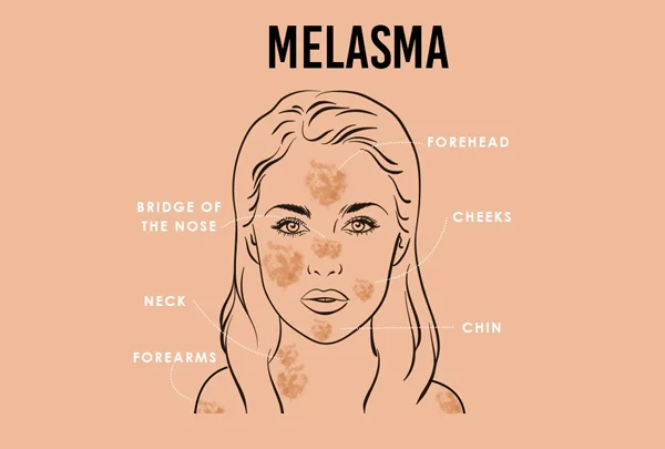 Maheshwari Skin and Hair Care Clinic